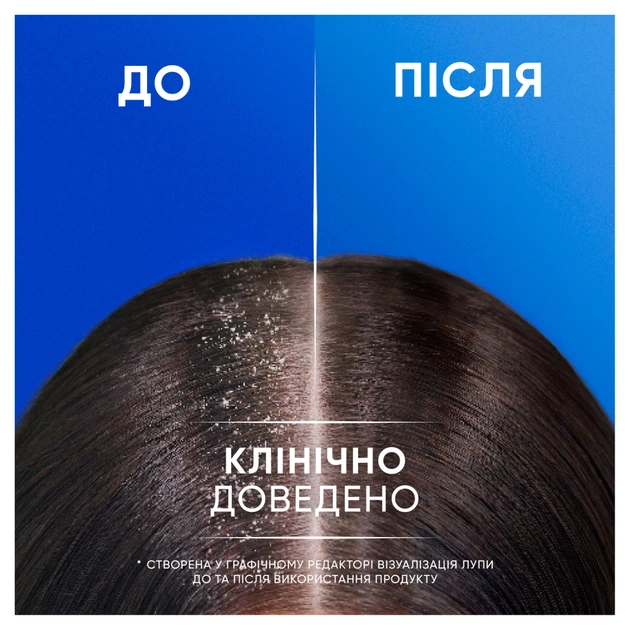 Шампунь Head & Shoulders 2 в 1 Проти лупи Основний догляд 400 мл (8700216304917) - зображення 5