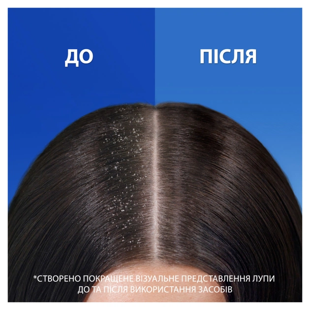 Шампунь Head & Shoulders 2 в 1 Проти лупи Свіжість ментолу 330 мл (8700216304825) - picture 6