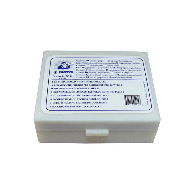 Набір мікропрепаратів Konus Патологічні тканини людського тіла, частина I 10 шт (4914) - picture 4