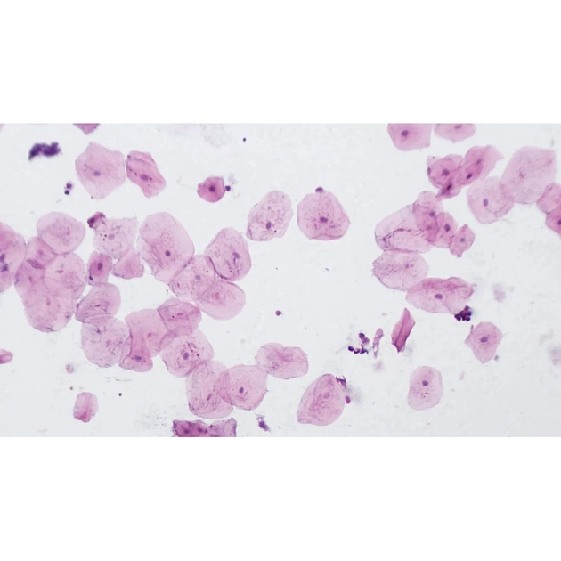 Набір мікропрепаратів Bresser високоякісних 10 шт (5984500) (931509) - picture 5