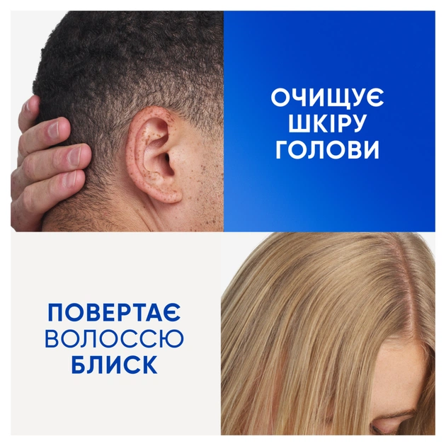 Шампунь Head & Shoulders Clarify & Shine Проти лупи Очищення та блиск 400 мл (8700216658461) - picture 6