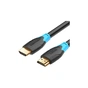 Кабель мультимедійний HDMI M to HDMI M 0.75m V2.0 4K60Hz black Vention (AACBE) - зменшене зображення 1