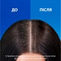 Шампунь Head & Shoulders Pro-Expert 7 Интенсивное спасение 250 мл (8700216156844) - уменьшенное изображение 3