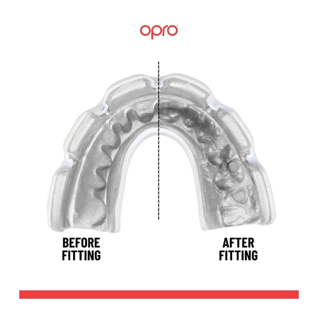 Капа Opro Instant Single Colour Braces Clear (102522007) (Instant_Braces_Clear) - picture 4