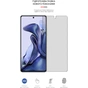 Плівка захисна Armorstandart Matte Xiaomi 11T (ARM61176) - зменшене зображення 2