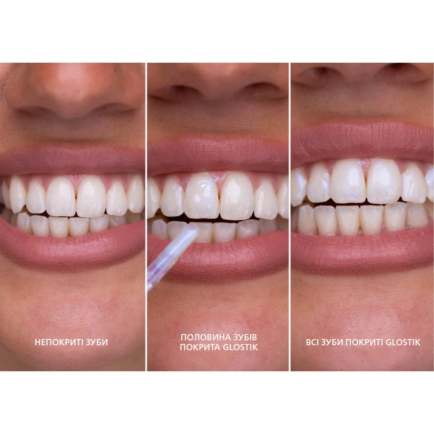 Засіб для відбілювання зубів SmileKit Glostik Блиск для зубів 4 мл (5.3020) - picture 5