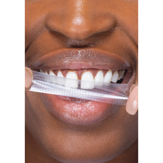 Засіб для відбілювання зубів SmileKit PAP+ Смужки 28 шт. (5.1510) - picture 6