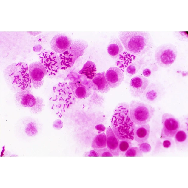 Набір мікропрепаратів Bresser Histology 30 шт (5985000) (931505) - picture 2