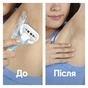 Бритва Gillette Venus Extra Smooth з 4 змінними картриджами + гачок для бритви (8700216969956) - зменшене зображення 7