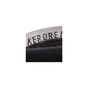 Фіксатор ліктя Adidas Performance Elbow Support ADSU-13332BL Чорний/Синій M (885652019415) - зменшене зображення 2