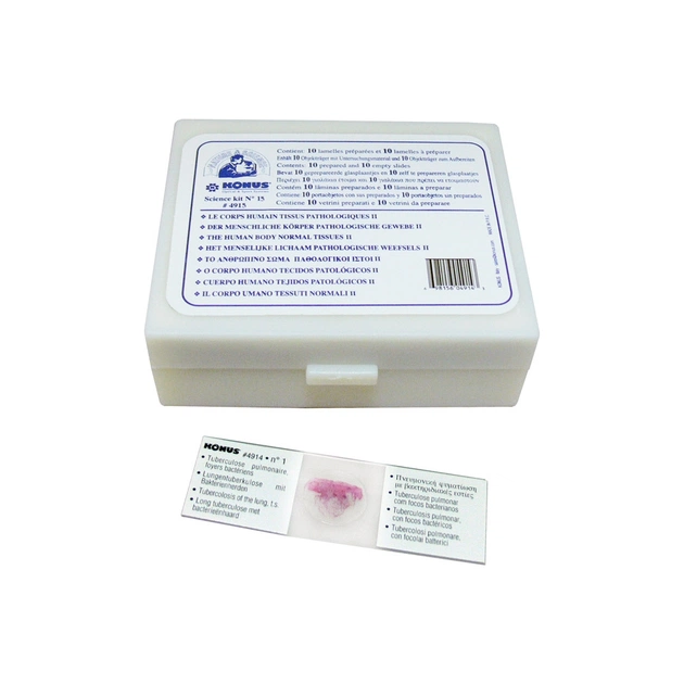 Набір мікропрепаратів Konus Патологічні тканини людського тіла, частина II 10 шт (4915) - picture 1