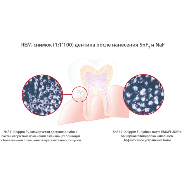 Зубна паста Dr. Wild Emofluor Daily Care зі стабілізованим фторидом олова 75 мл (7611841701686) - picture 4