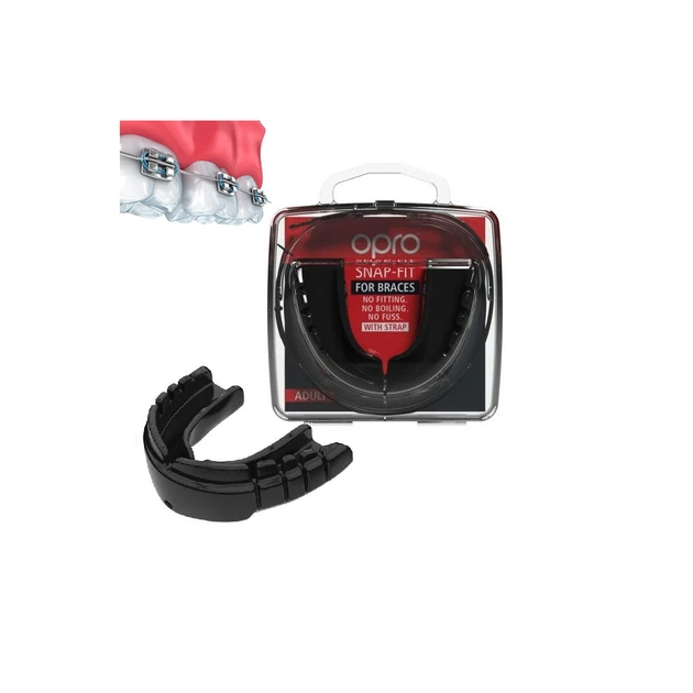 Капа Opro Snap-Fit Braces під брекети Black (SN_Braces_Black) - picture 2