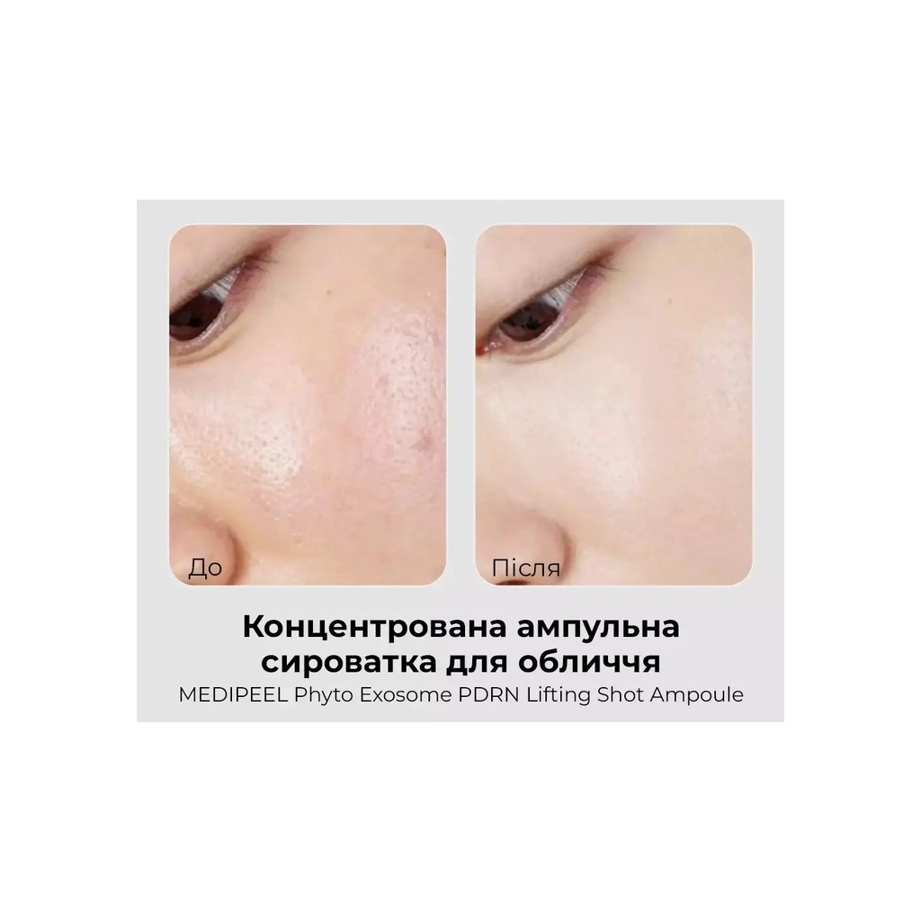 Сироватка для обличчя Medi-Peel Phyto Exosome PDRN Lifting Shot Serum 100 мл (8809941824681) - изображение 3