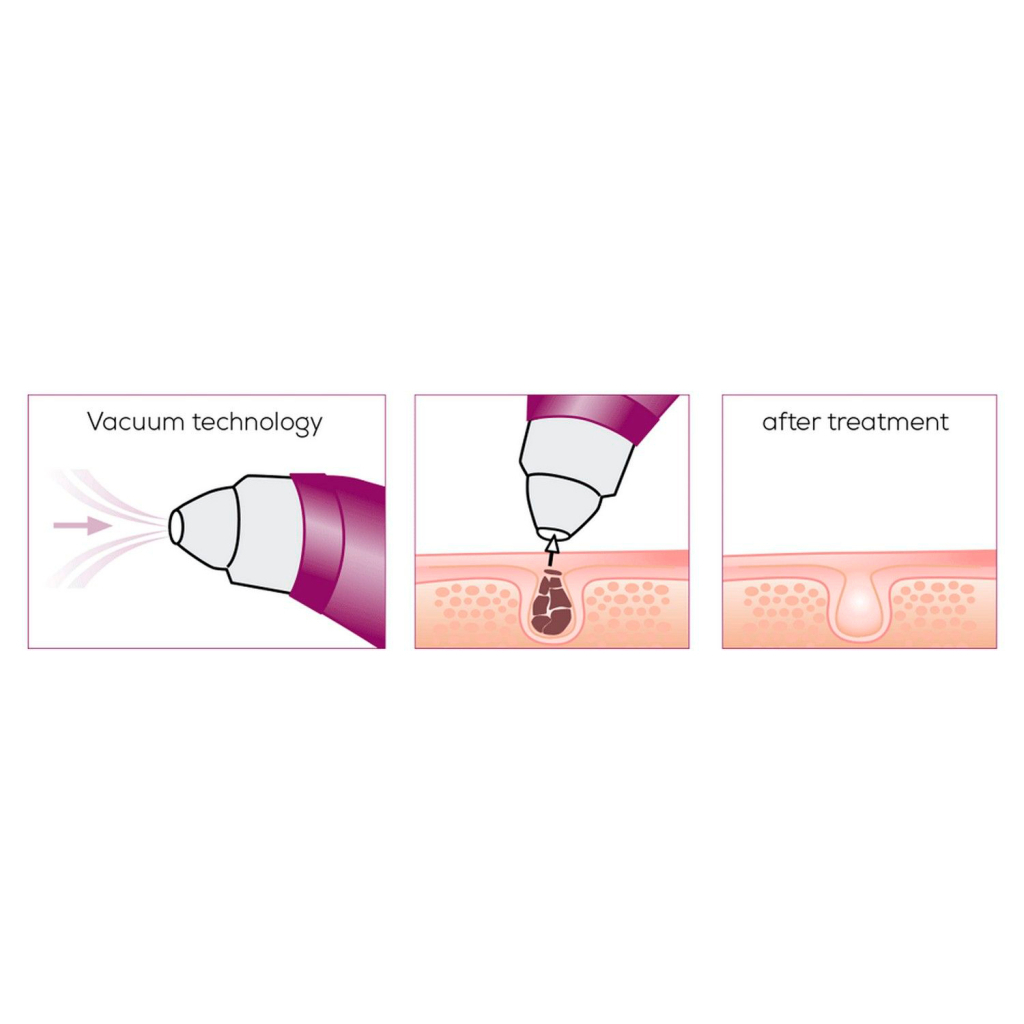 Прилад для чищення шкіри обличчя Beurer FC 41 - зображення 7