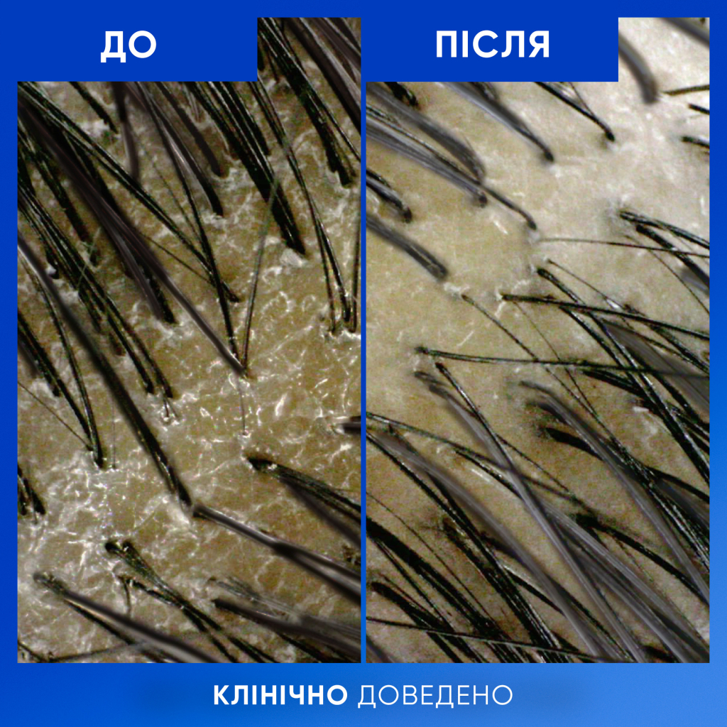 Шампунь Head & Shoulders Clarify & Shine Проти лупи Очищення та блиск 400 мл (8700216658461) - зображення 7