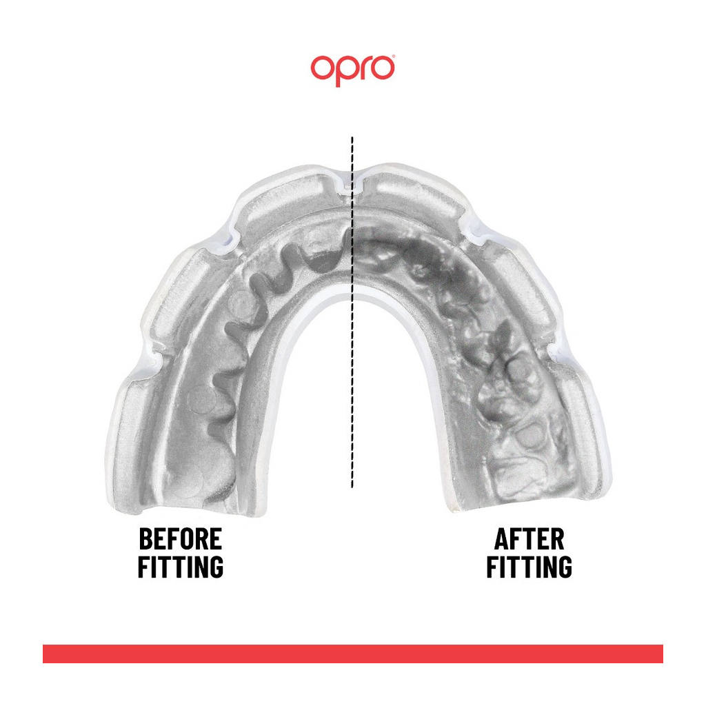 Капа Opro Instant Single Colour Braces Clear (102522007) (Instant_Braces_Clear) - изображение 4