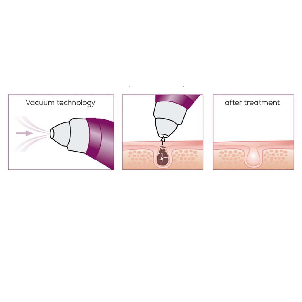 Масажер Beurer FC 41 (FC_41) - зображення 7