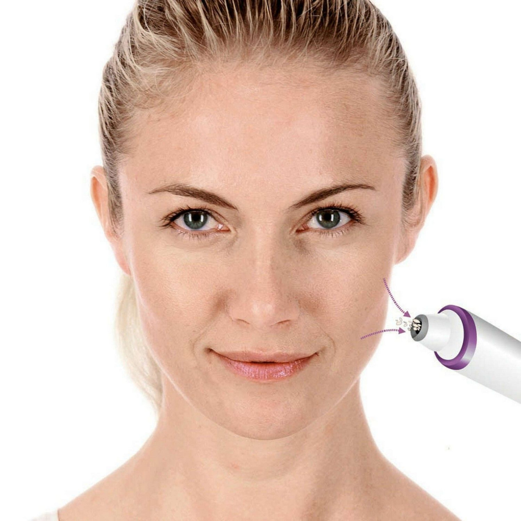 Прилад для чищення шкіри обличчя Beurer FC 76 - зображення 4