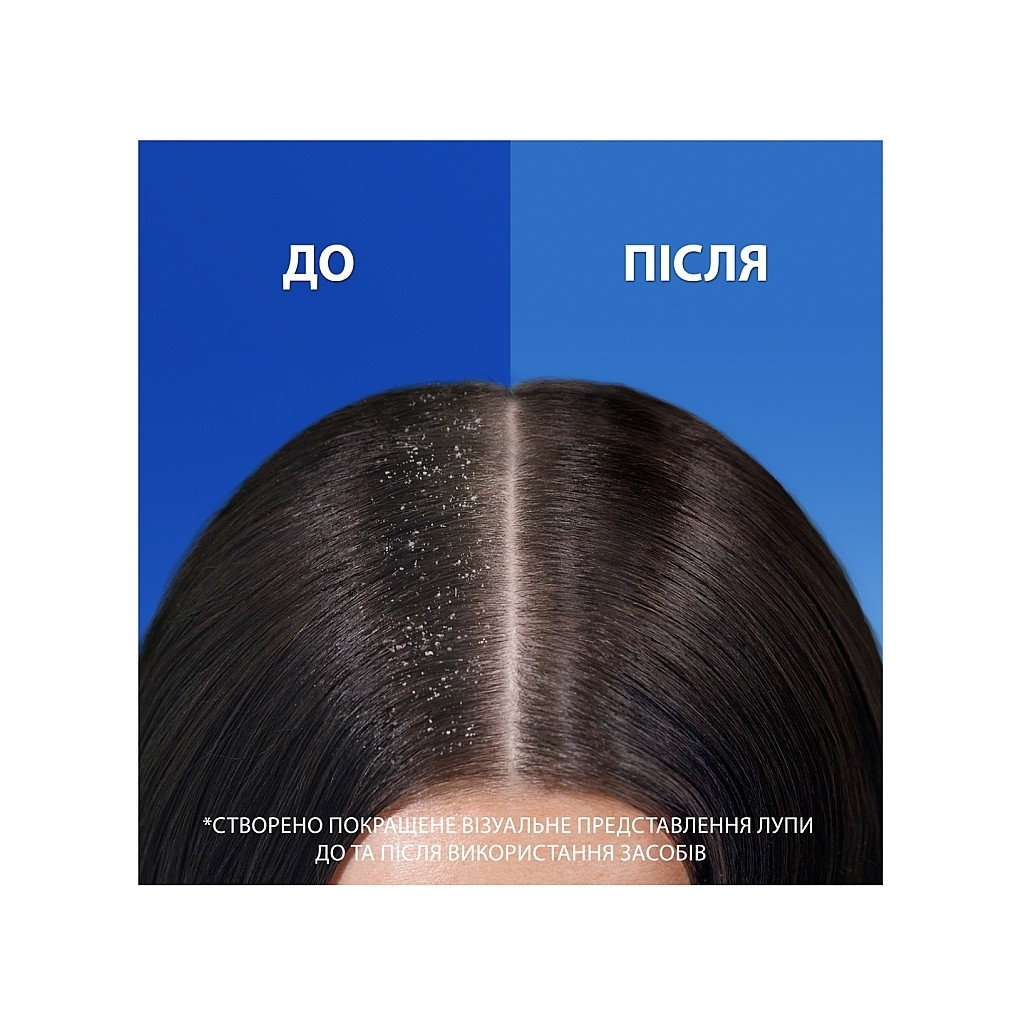 Шампунь Head & Shoulders 2 в 1 Проти лупи Гладеньке та шовковисте 330 мл (8700216304856) - зображення 3