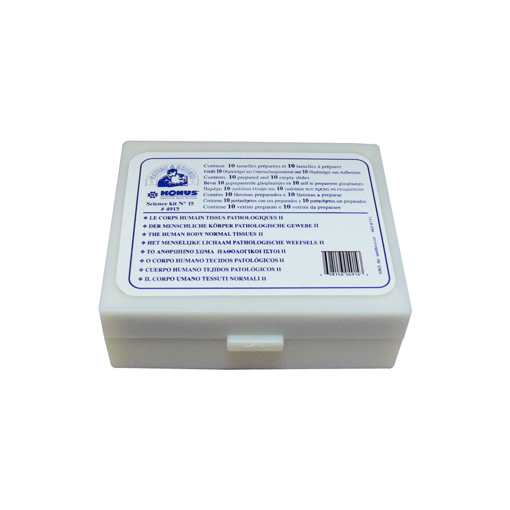 Набір мікропрепаратів Konus Патологічні тканини людського тіла, частина II 10 шт (4915) - зображення 4