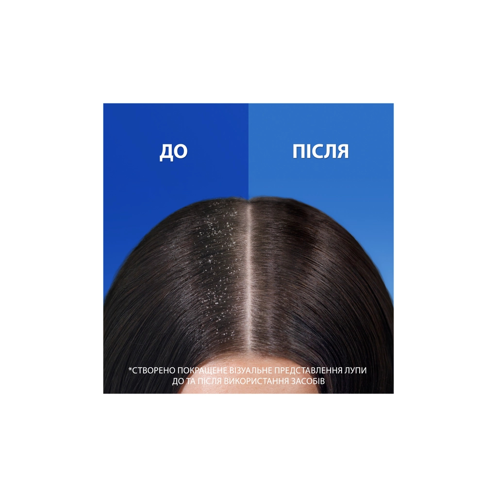 Шампунь Head & Shoulders 2 в 1 Проти лупи Свіжість ментолу 625 мл (8700216305372) - зображення 3