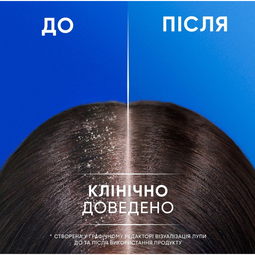 Шампунь Head & Shoulders 2 в 1 Проти лупи Яблучна свіжість 330 мл (8700216304689) - зображення 6