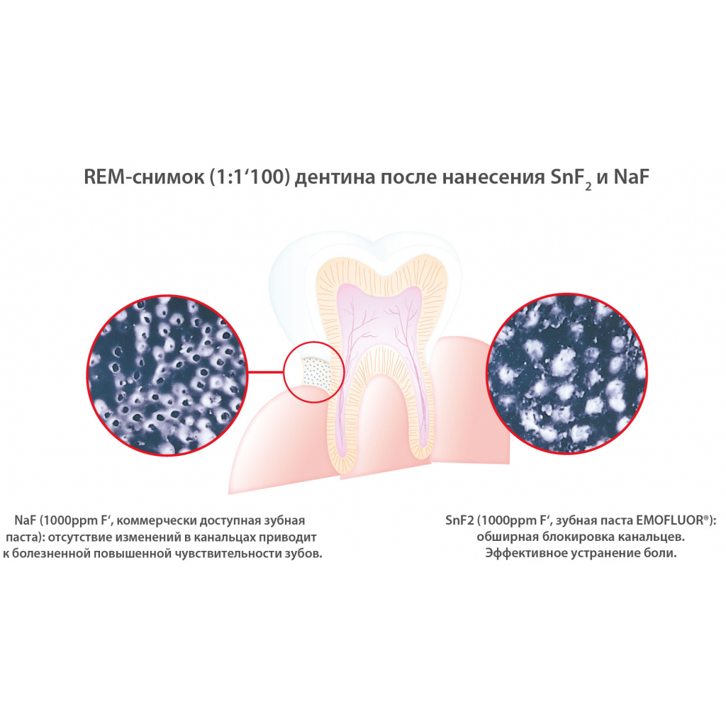 Зубна паста Dr. Wild Emofluor Daily Care зі стабілізованим фторидом олова 75 мл (7611841701686) - изображение 4